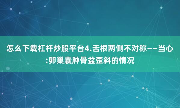 怎么下载杠杆炒股平台4.舌根两侧不对称——当心:卵巢囊肿骨盆歪斜的情况